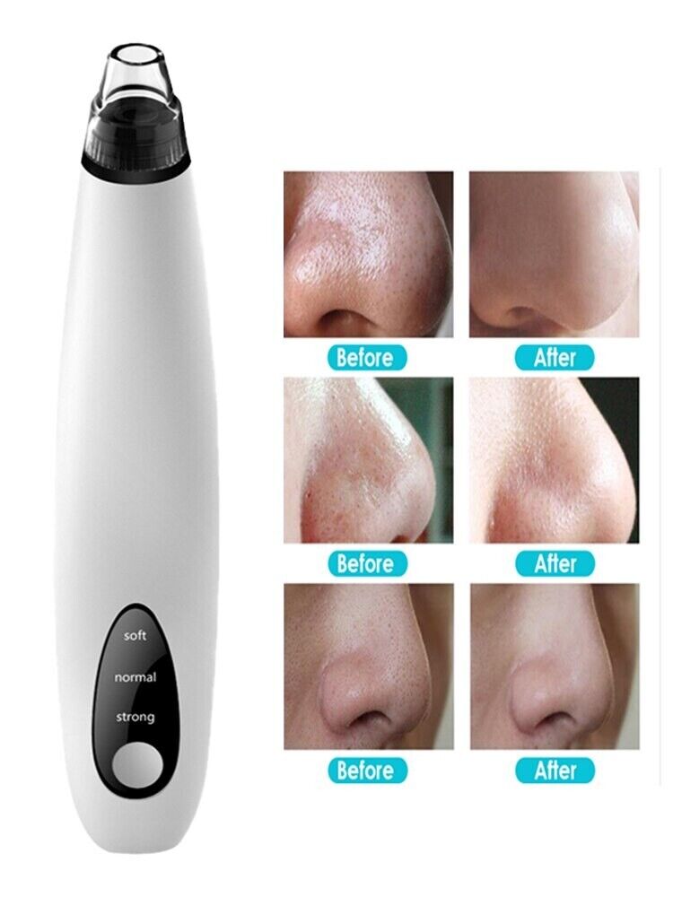 Electric Blackhead Remover Cleaner Face Diamond Pore Vacuum Suction White Heads - LAVANDOElectric Blackhead Remover Cleaner Face Diamond Pore Vacuum Suction White HeadsElectric Blackhead Remover Cleaner Face Diamond Pore Vacuum Suction White Heads
