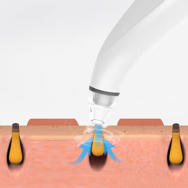 Electric Blackhead Remover Cleaner Face Diamond Pore Vacuum Suction White Heads - LAVANDOElectric Blackhead Remover Cleaner Face Diamond Pore Vacuum Suction White HeadsElectric Blackhead Remover Cleaner Face Diamond Pore Vacuum Suction White Heads
